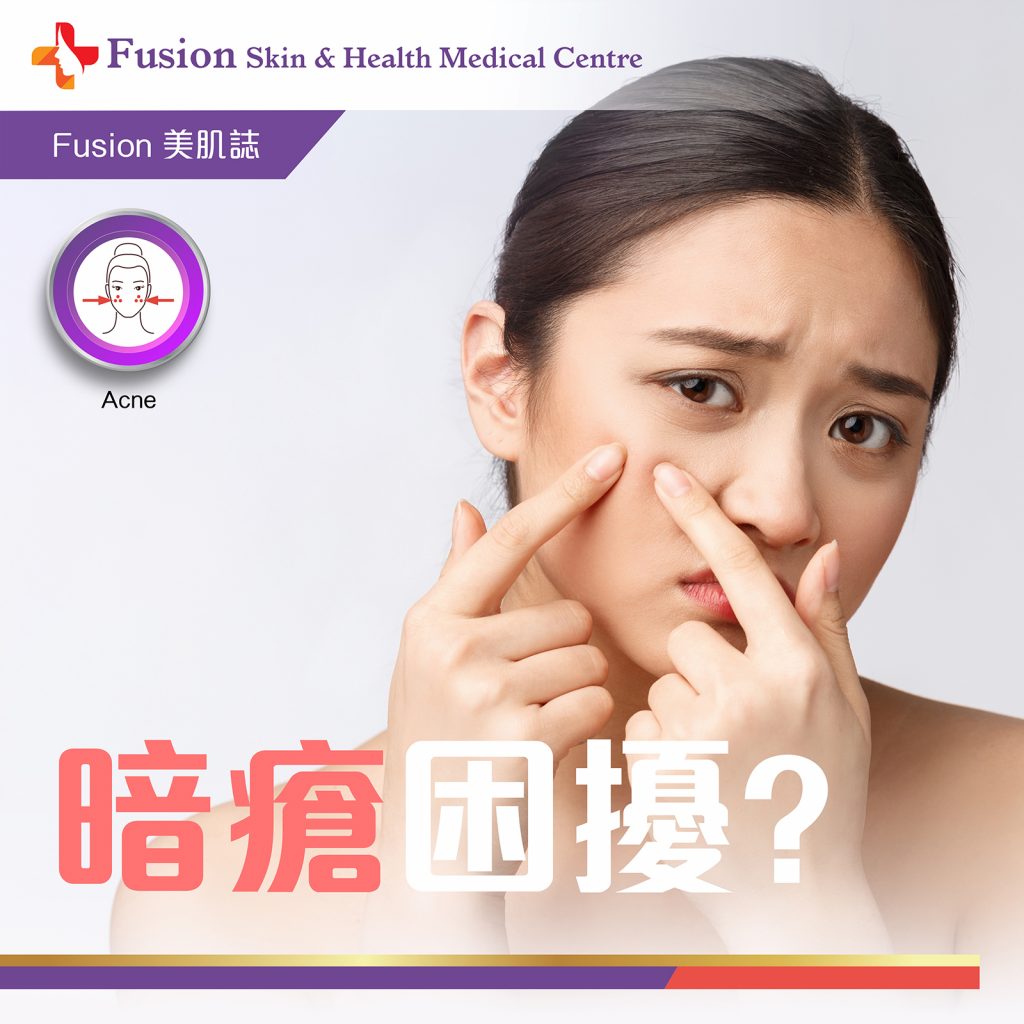 暗瘡困擾 - Fusion Skin & Health Medical Centre