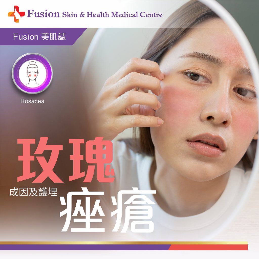 玫瑰痤瘡 - Fusion Skin & Health Medical Centre